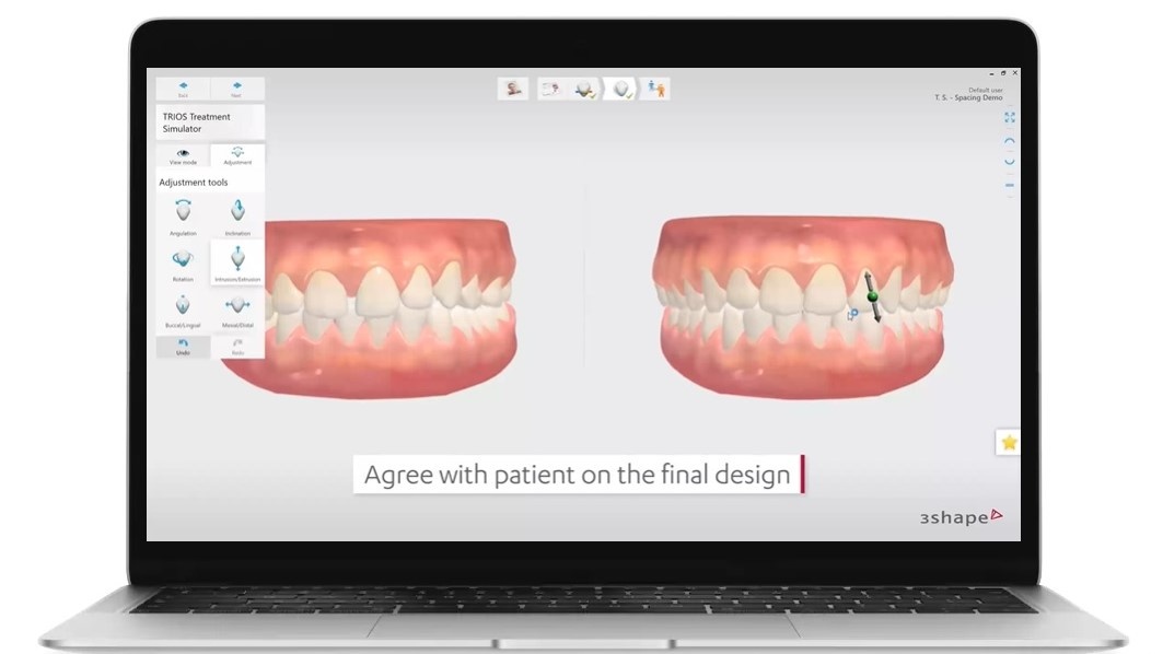 Сканирование и дизайн улыбки