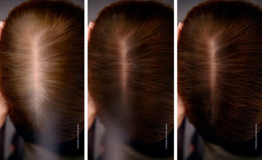 Что делать если волосы седые быстро отрастают после окрашивания