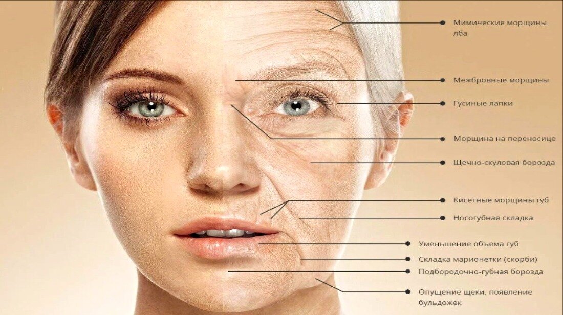 Источник: avatars.mds.yandex.net