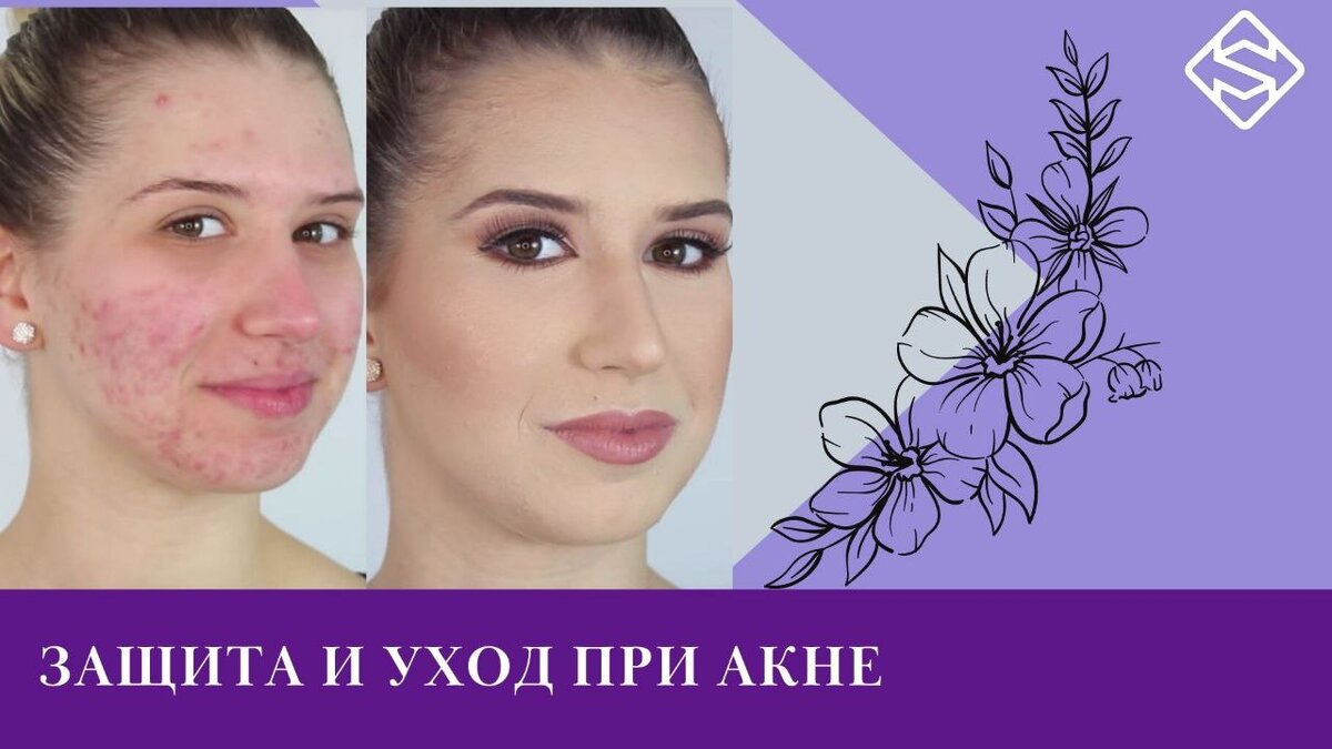 Коллаж STEPMEDICALS