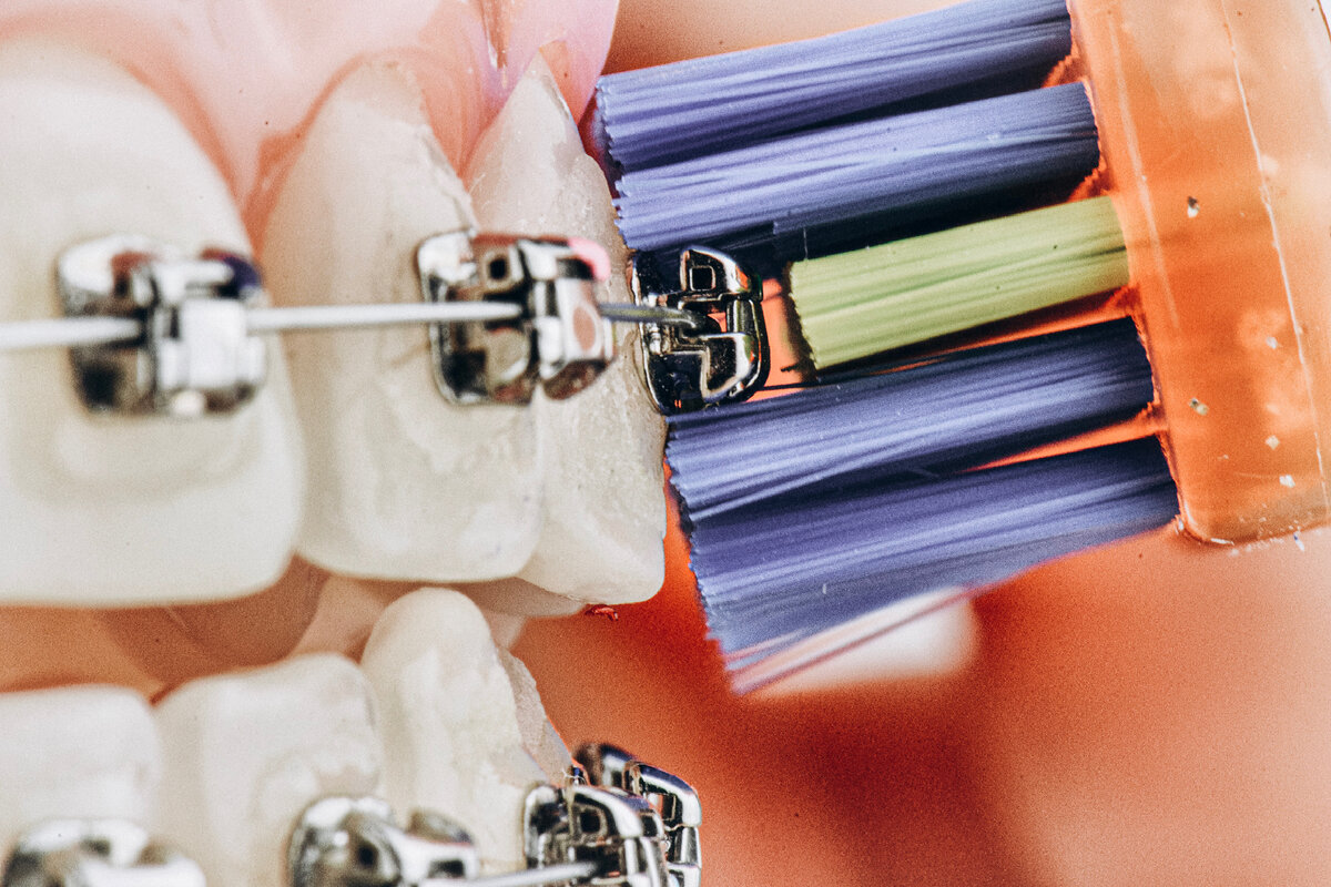 Ортодонтическая щетка со специальным желобком посередине 