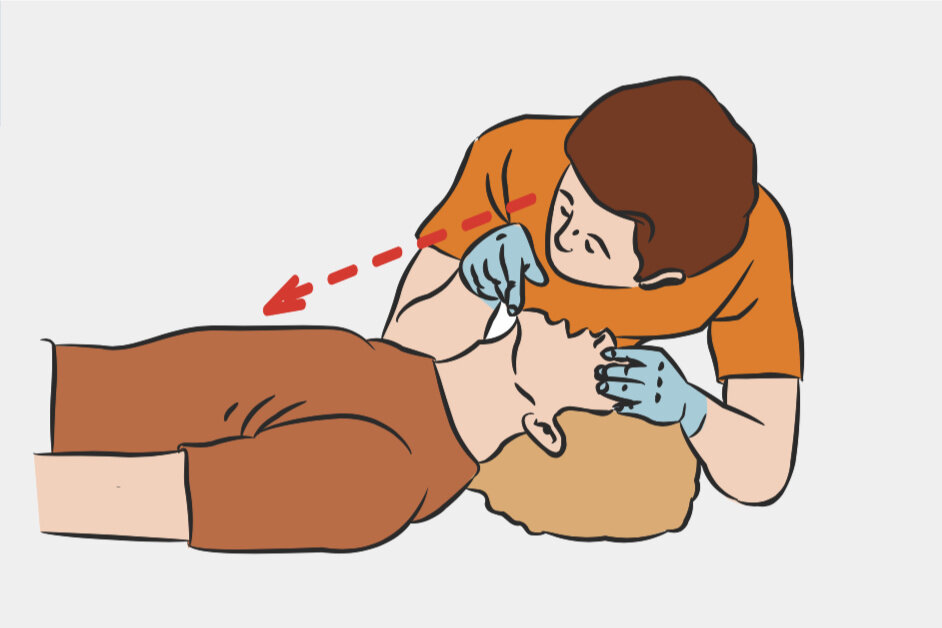 Проверка дыхания. Ухо прислоняем к лицу пострадавшего, взгляд устремлен на грудную клетку.