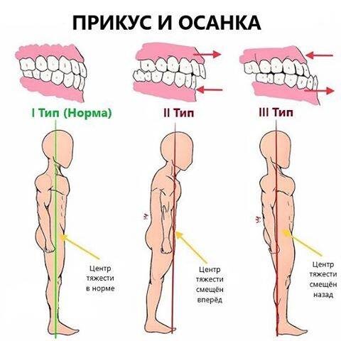 изменения в сагиттальной плоскости