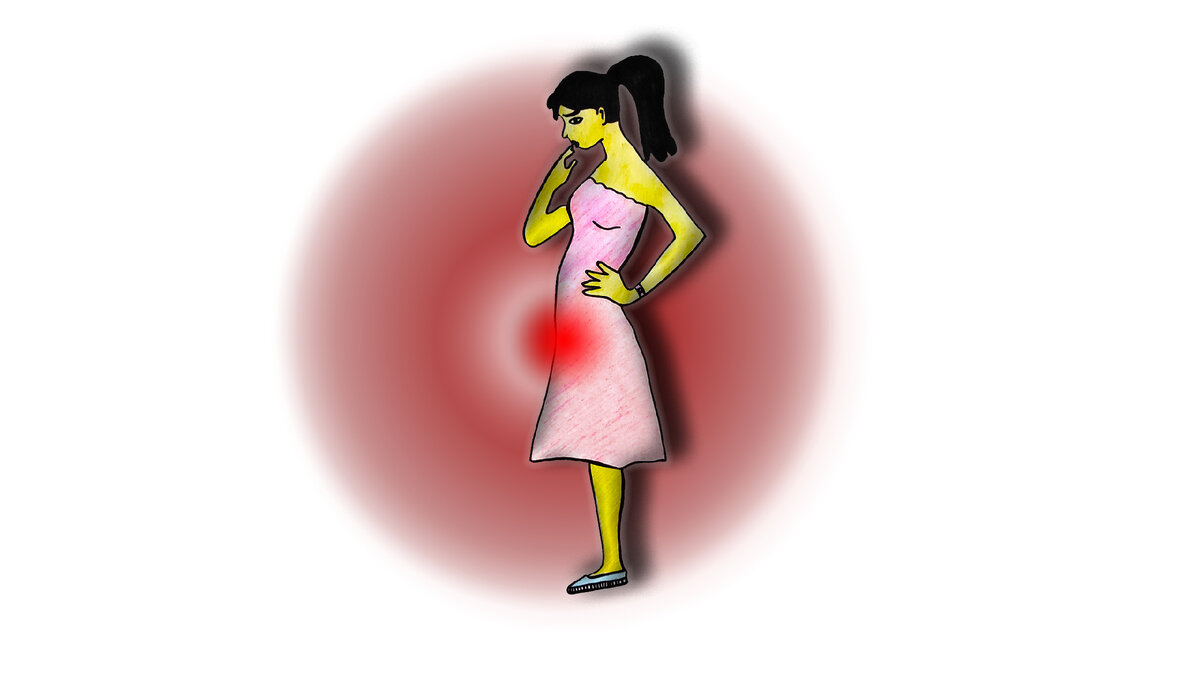 Рисунок 1—Женское бесплодие. Причины, диагностика, лечение заболевания.