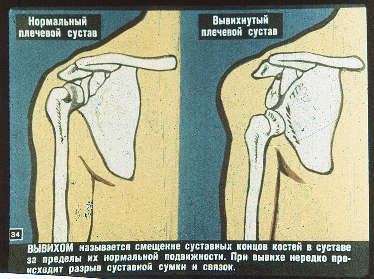 Диафильм «Первая медицинская помощь при травмах». | Павел Стенчев | Дзен