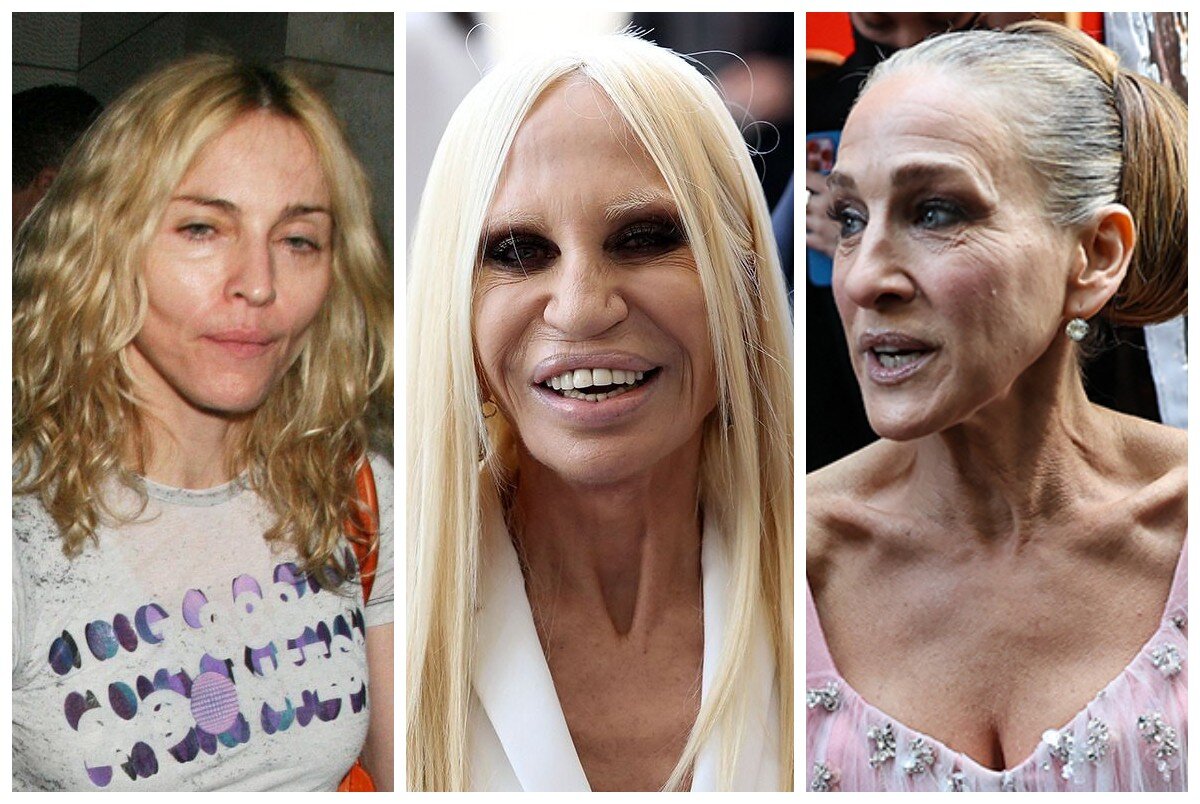 Сары после. Donatella Versace до пластики.