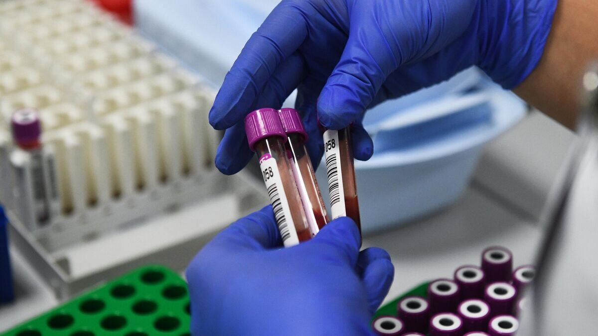    Лаборатория биохимических и иммунохимических исследований © РИА Новости / Александр Кряжев