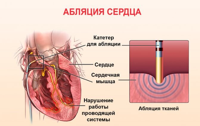 Картинка из интернета