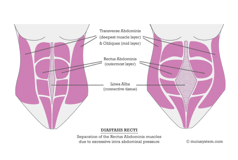 Rectus Abdominis-прямая мышца живота, linea alba-белая линия живота.