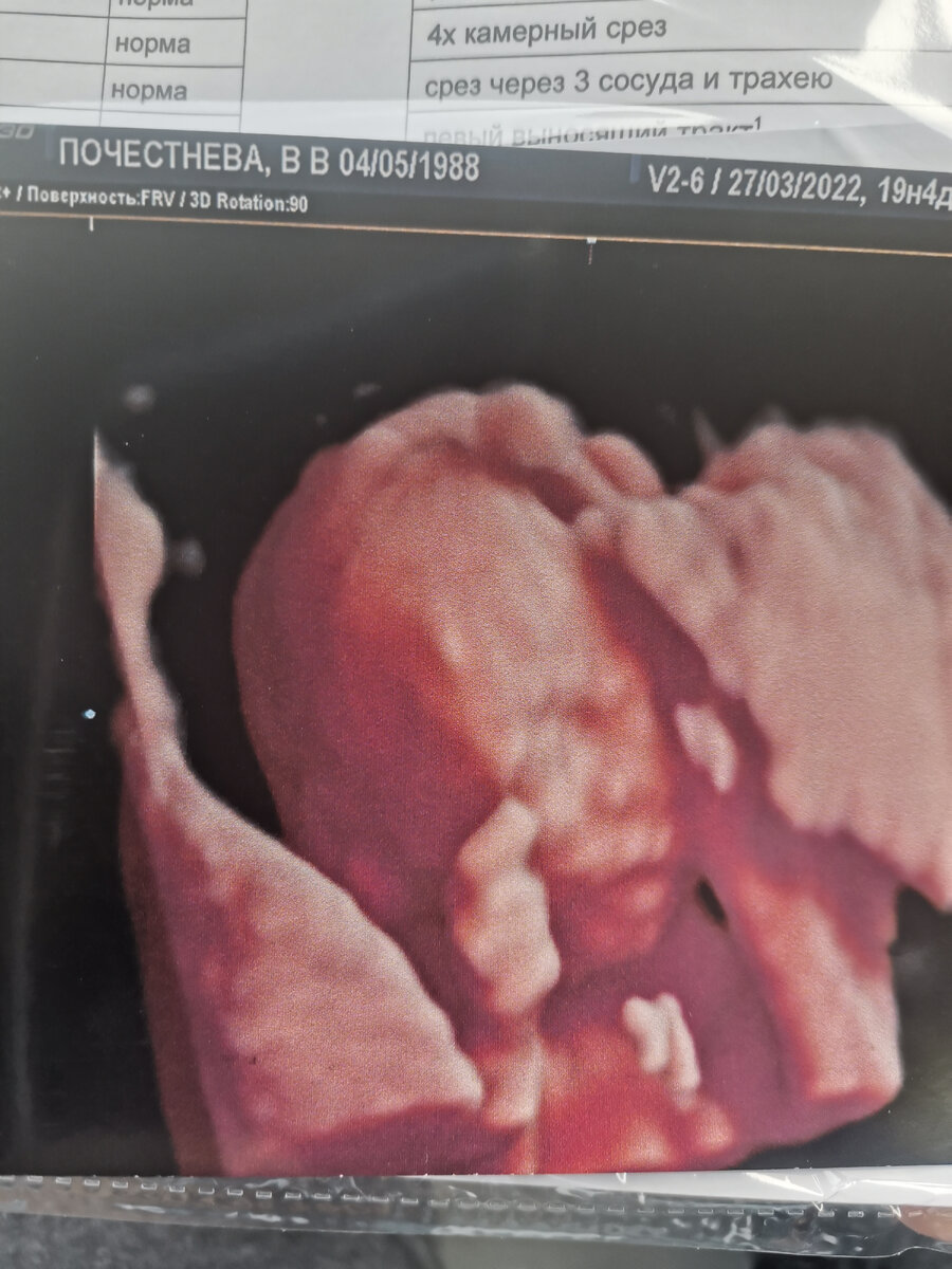 Вот такой вот. Настоящий сын.) 