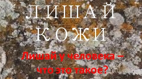 Что такое Лишай кожи