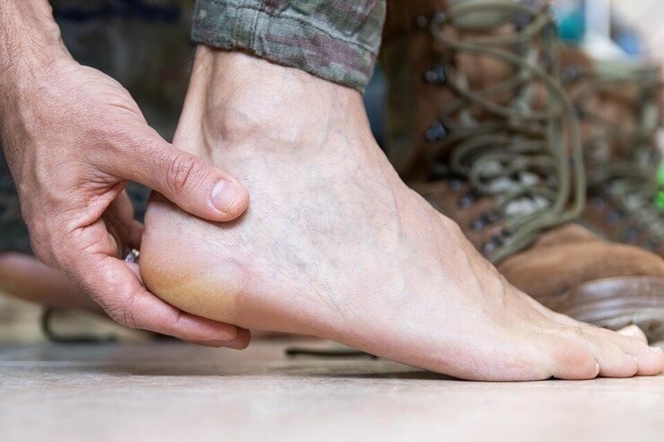     Пяточная шпора просто выбивает человека из нормальной жизни. Фото: freepik.com