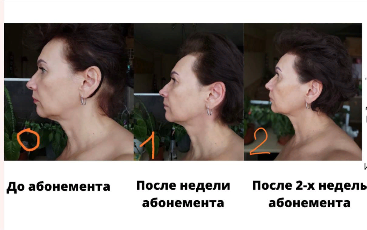 (пример этому Алина на фото. 53 года, изменения за 2 недели)