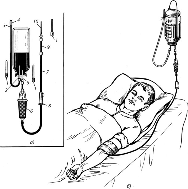 Капельница. Фото с сайта https://studref.com/428637/meditsina/lechebnye_meropriyatiya_ostroy_krovopotere