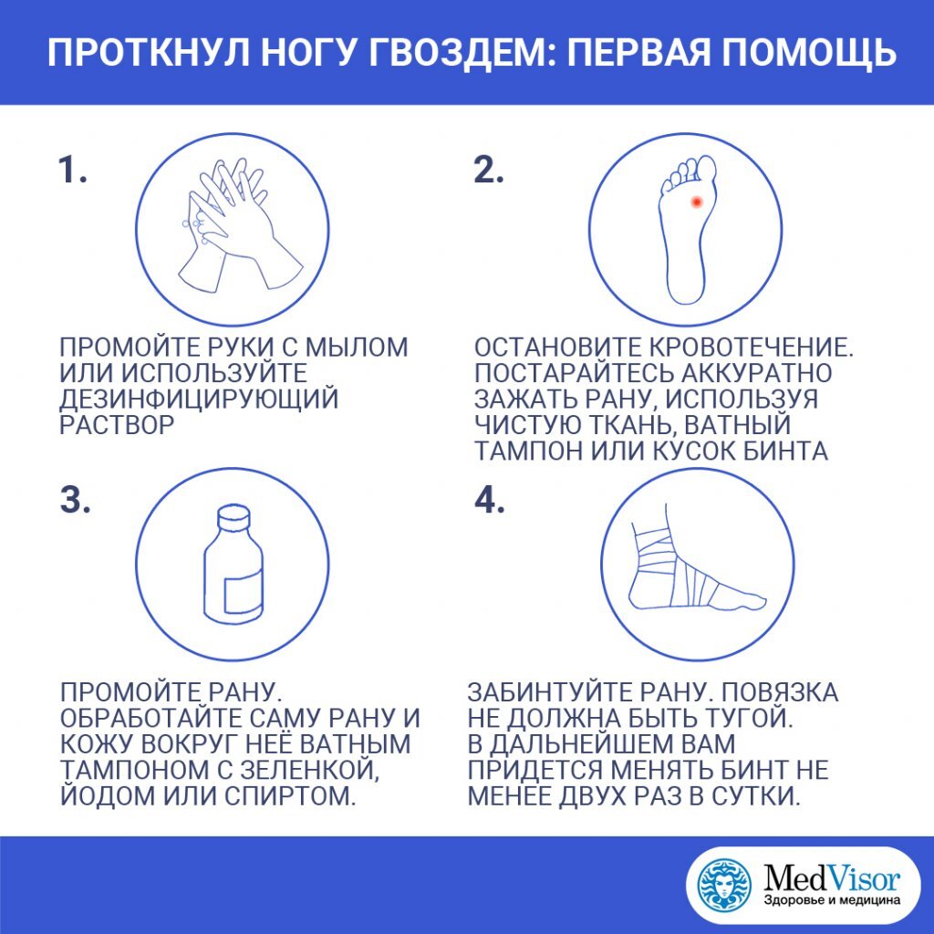 Наступил на ржавый гвоздь: что делать в домашних условиях взрослому, как оказать первую помощь