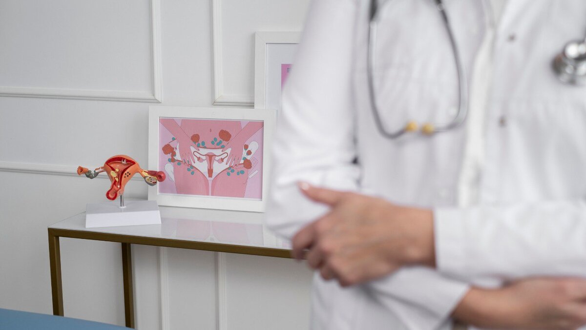 Молочница: причины, симптомы и лечение вагинального кандидоза ...