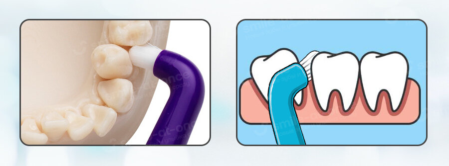 Фотоколлаж: Smile-at-Once.ru.