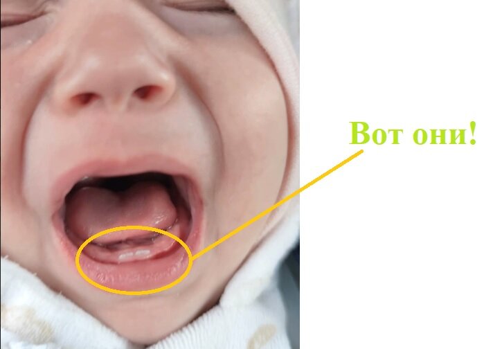 В 4,5 месяца вылезла первая пара зубов. Фото: личный архив