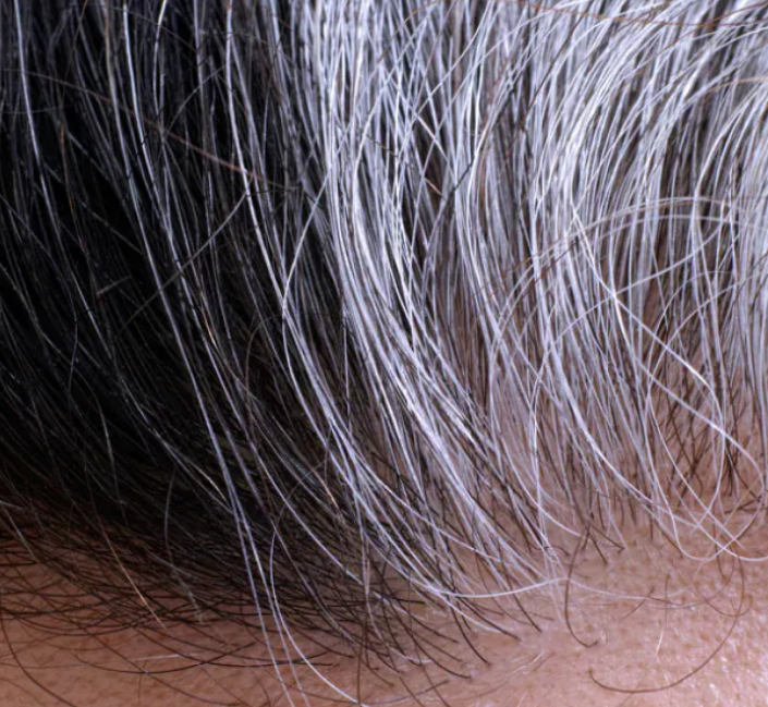 Могут ли седые волосы снова вернуть свой природный цвет волос