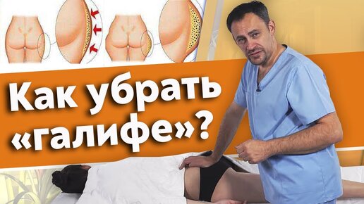 Массажные движения для бедер. Как убрать ГАЛИФЕ на бедрах ?