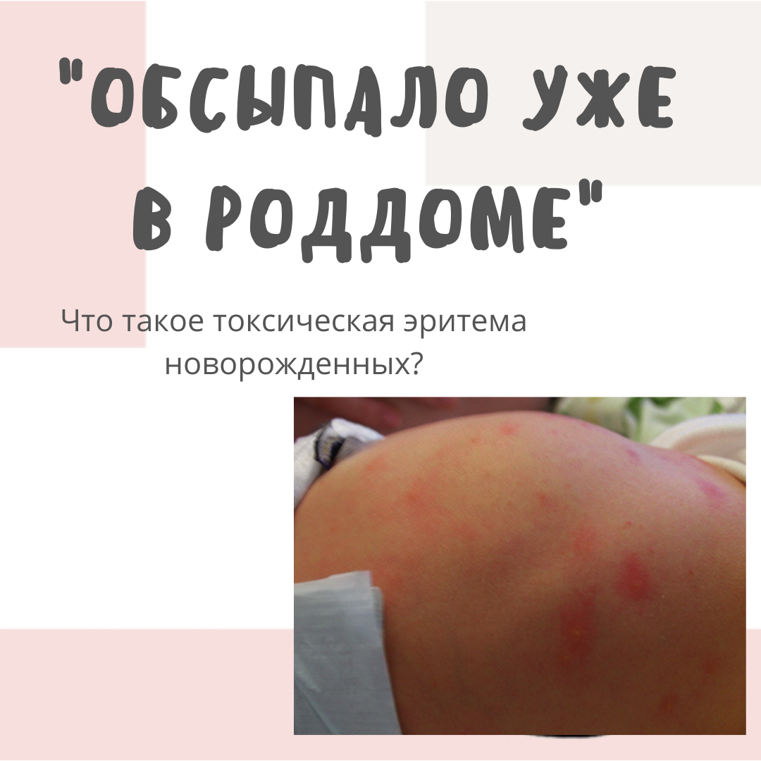 Пример того, как может выглядеть ТЭН