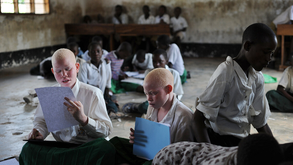 Люди альбиносы фото в африке