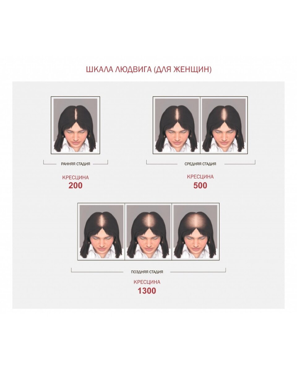 Шкала Людвига (для женщин)