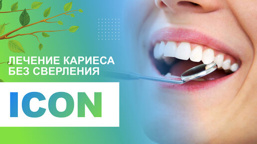 🦷 Лечение кариеса без сверления методом ICON