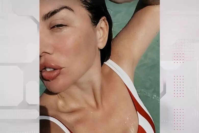 -2