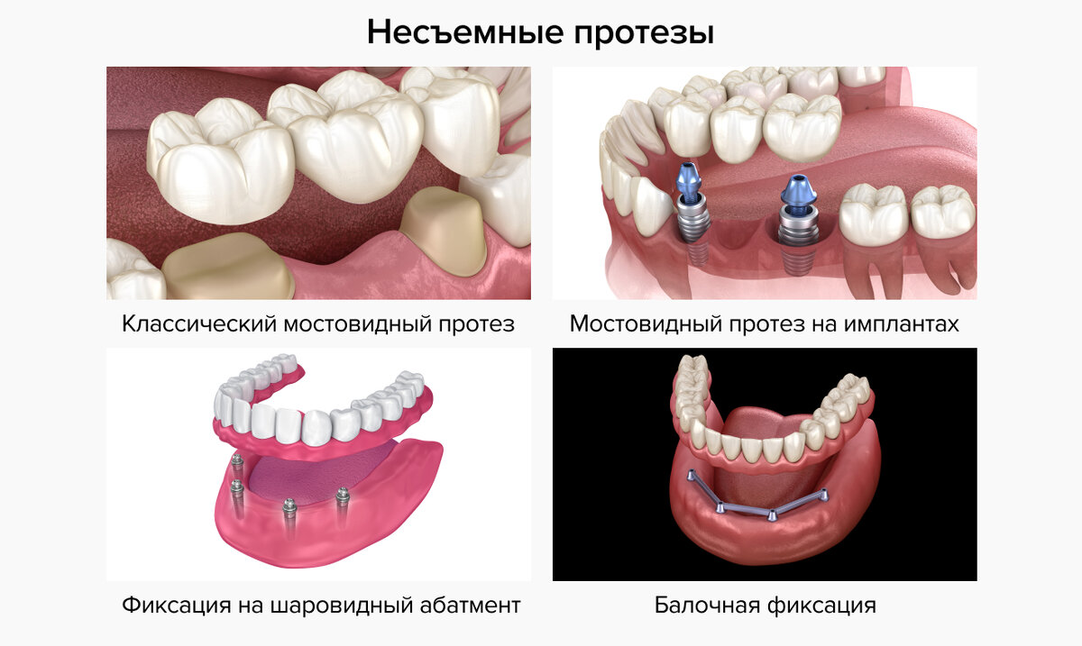 Самые красивые зубы Голливуда