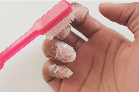 Очень простой, дешевый и проверенный способ удалить кутикулу без какого-либо инструмента и специальных растворов я узнала недавно от моей знакомой.-4