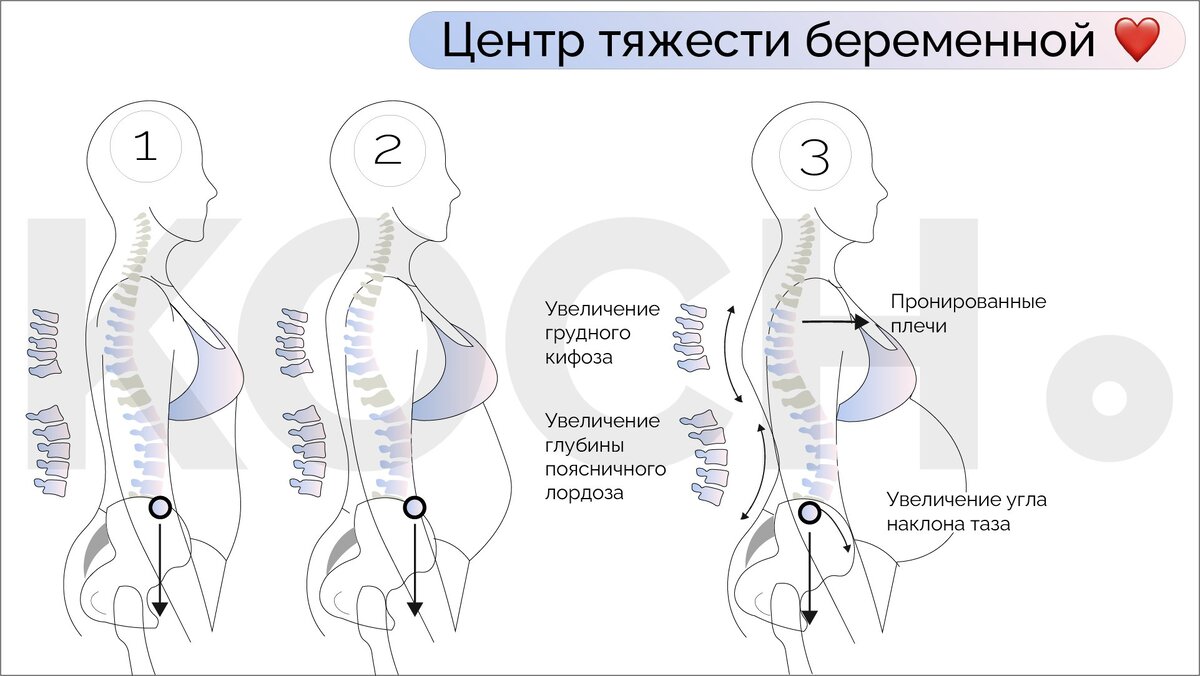 Как меняется тело во время беремености? | Юлия Кочкина | Дзен