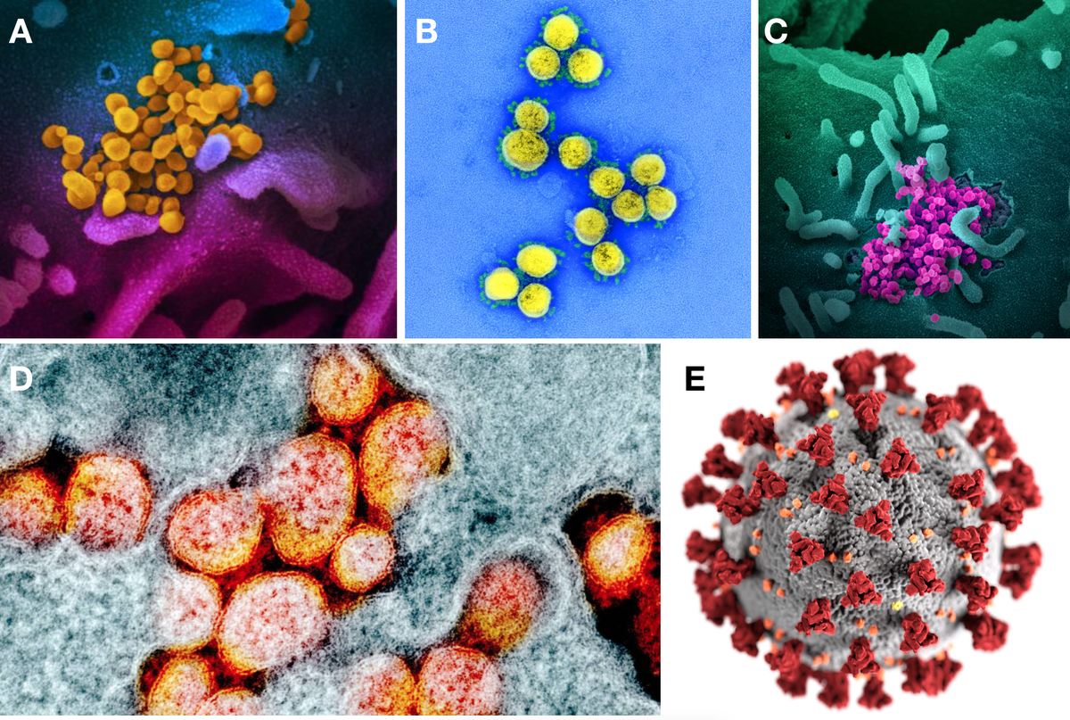 Микрофотографии виновника торжества —  вируса SARS-CoV-2