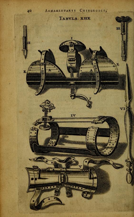 Гравюра из книги Scultetus J. Cheiroplotheke, seu ... Armamentarium chirurgicum opus posthumum ... in quo tot, tam veterum ac recentiorum instrumenta ab authore correcta, quàm noviter ab ipso inventa, quot ferè hodiè ad usitatas operationes manuales feliciter peragendas requiruntur ... depicta reperiuntur. 1656.