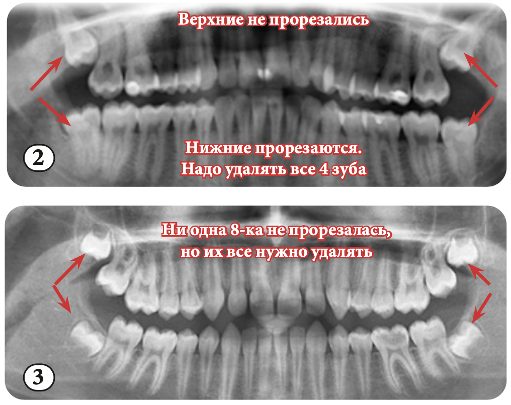 Возрастные особенности изображения зубов и челюстей в норме на рентгенограммах