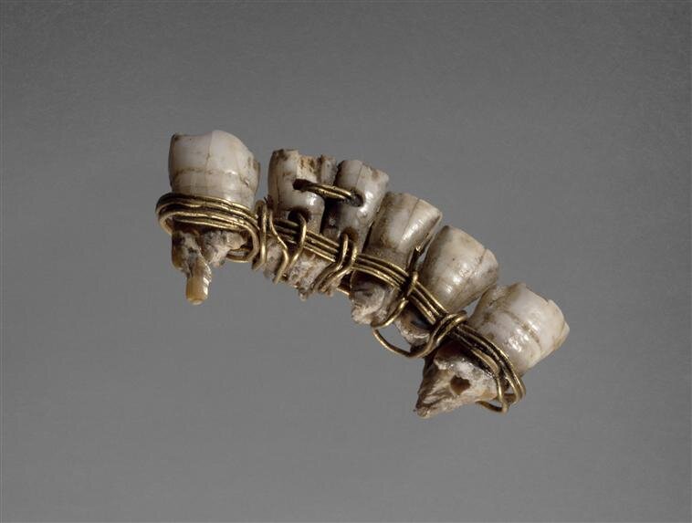 Чудовищная стоматология древнего мира