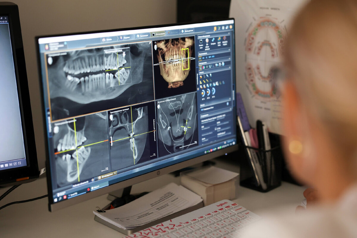 Компьютерным томографом Dentsply Sirona "AXeos