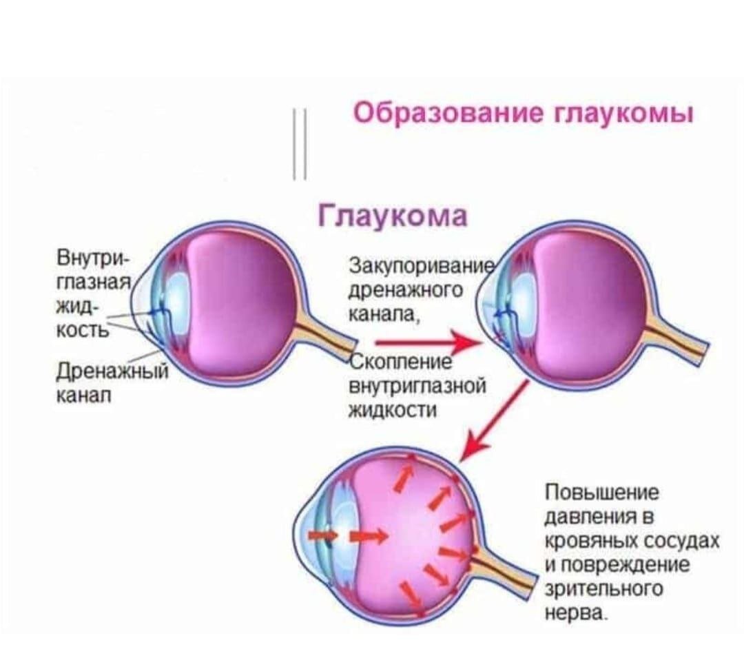 Ухудшилось зрение форум