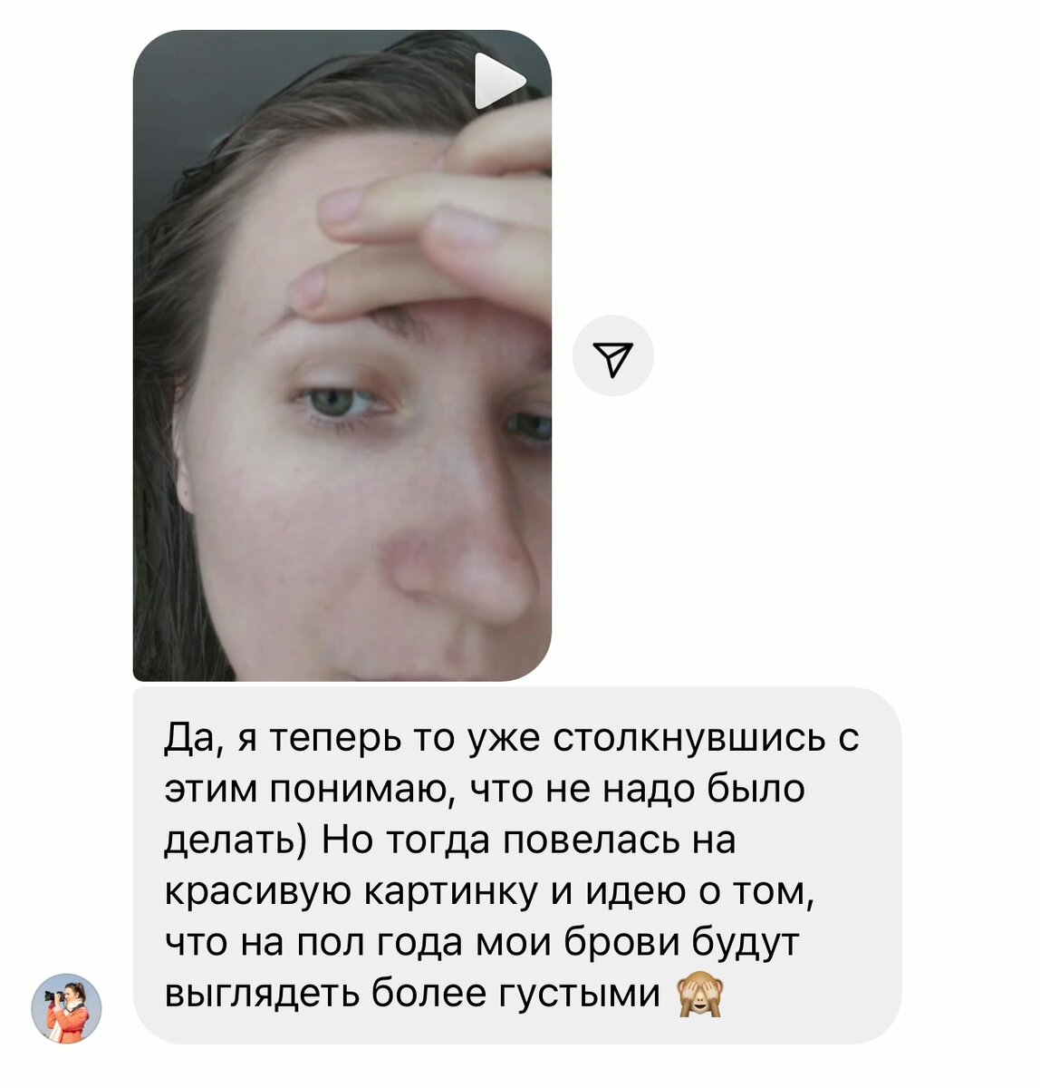 Красивая картинка сразу после процедуры Wow-эффект.  В последствии красные брови и шрамы. 