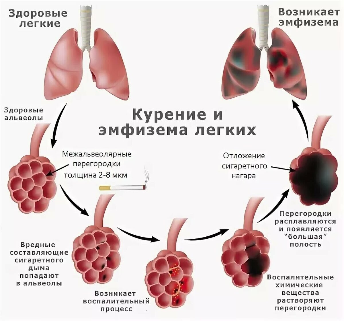 После курения болит грудная клетка: что делать, как убрать боль