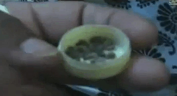 Камешки, которые "выплакала" Саадия Салех