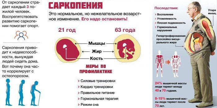 Слабость после 50 лет у мужчин. Потеря мышечной массы с возрастом. Саркопения. Саркопения симптомы. Возрастное снижение мышечной массы.