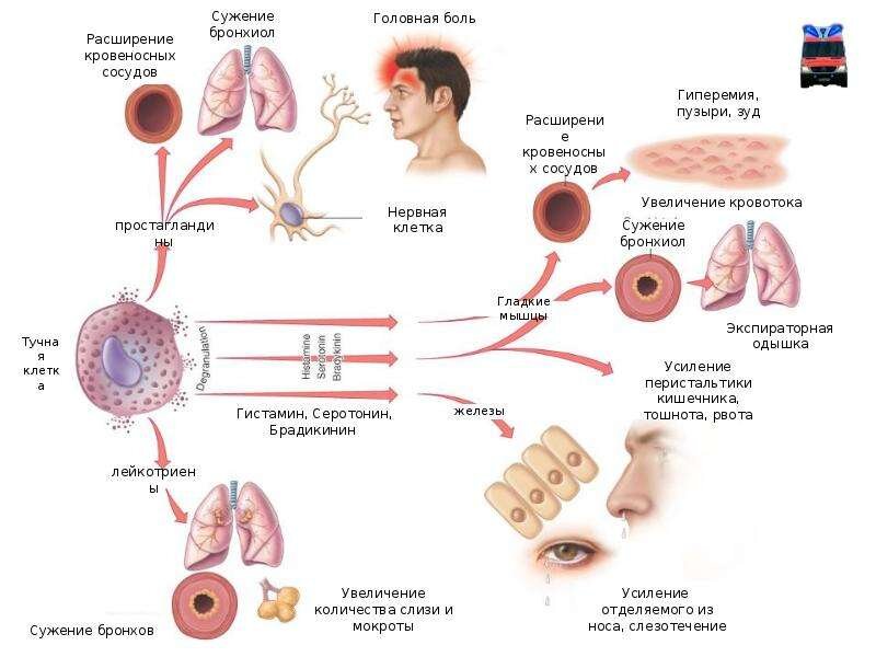 Презентация аллергия казакша