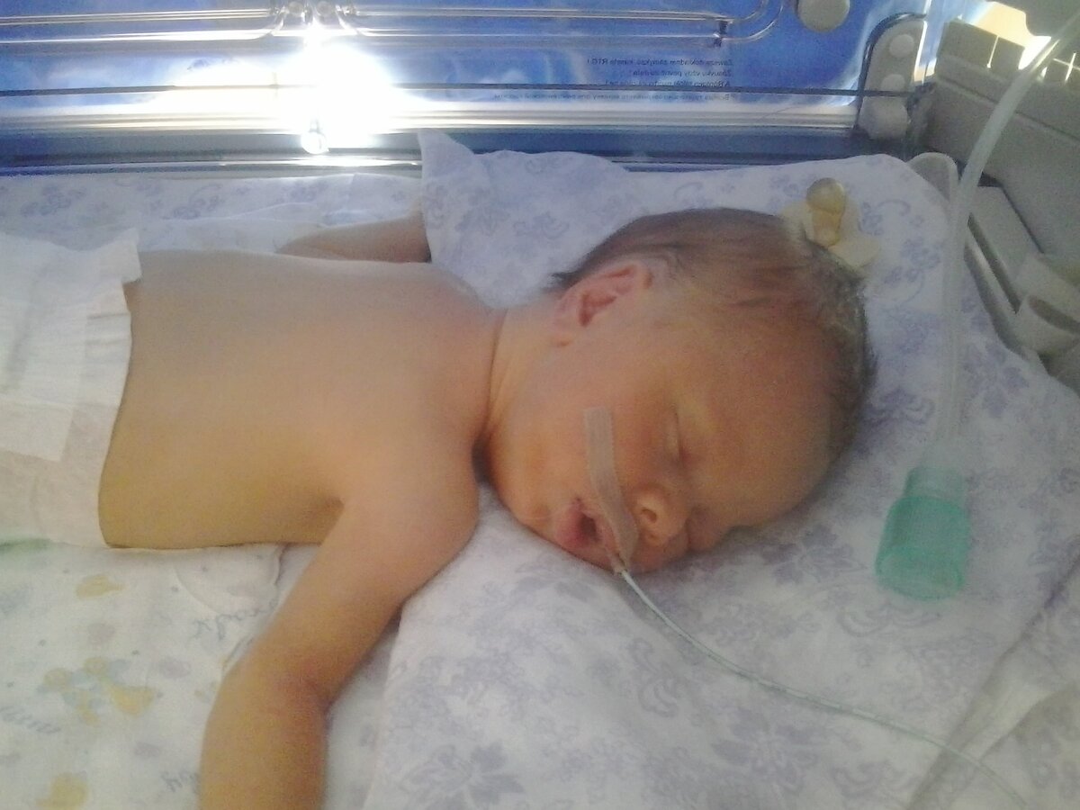 В реанимации 