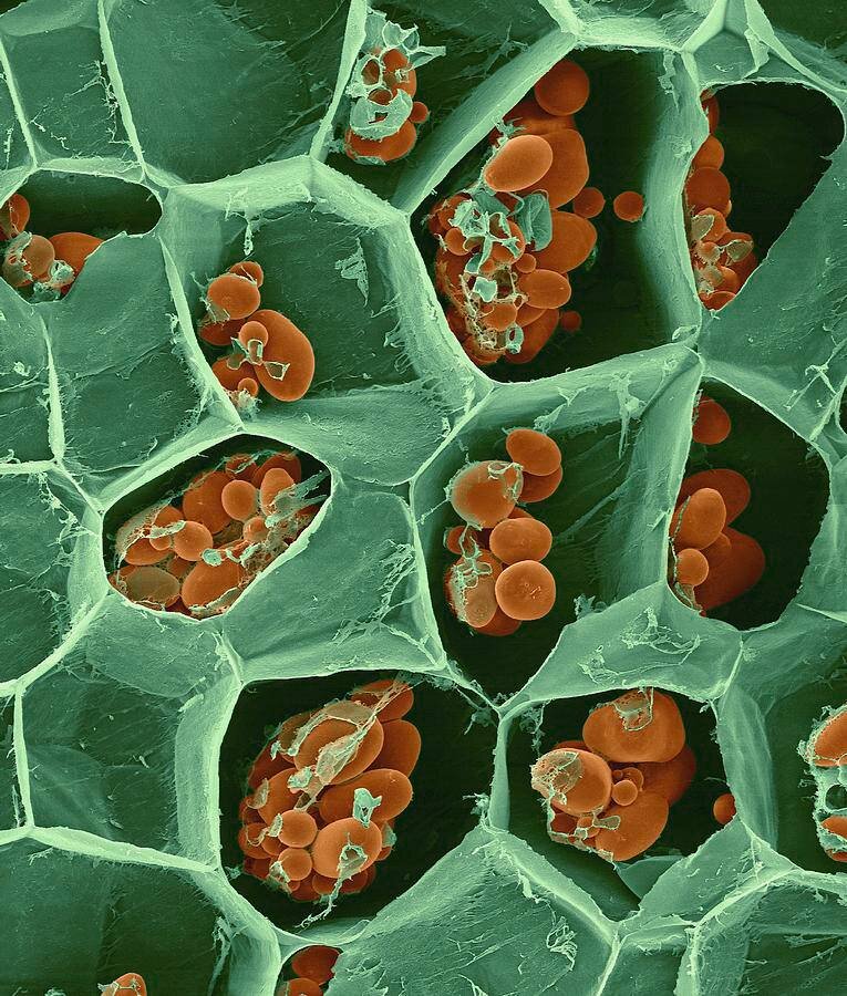 Клетки картофеля