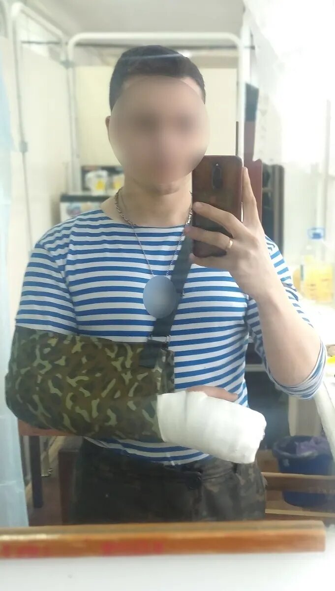 Рука военнослужащего травмирована и нуждается в хорошей реабилитации и лечении. Фото: предоставлено героем публикации