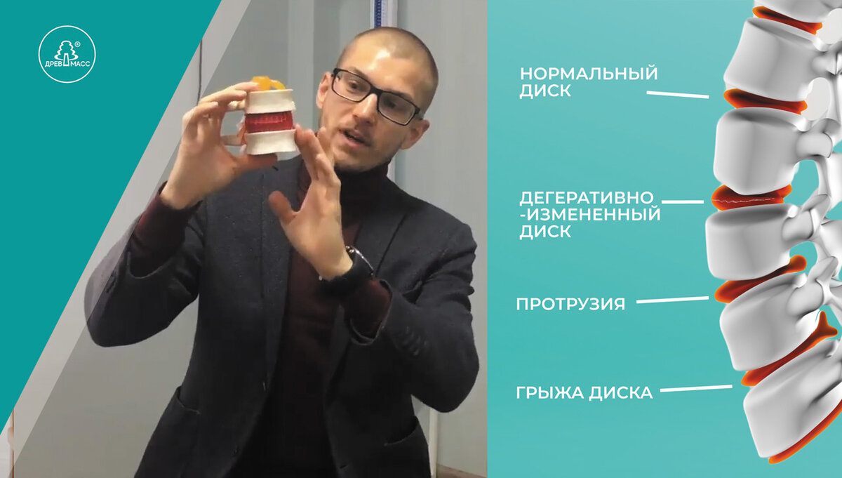 Позвоночник – это опора всего организма. Межпозвоночные диски – амортизаторы. Фиброзное кольцо – защита наших гелеобразных амортизаторов от смещения.