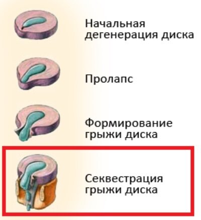 Источник фотографии: https://ortodilen.ru/wp-content/uploads/0/3/e/03eb9e6f786b06a694417cad9e9c01d9.png