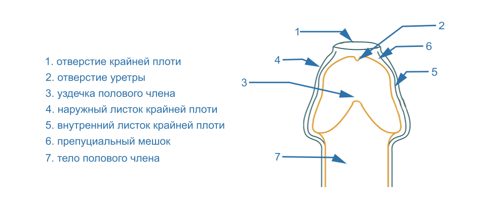 Виды фимоза