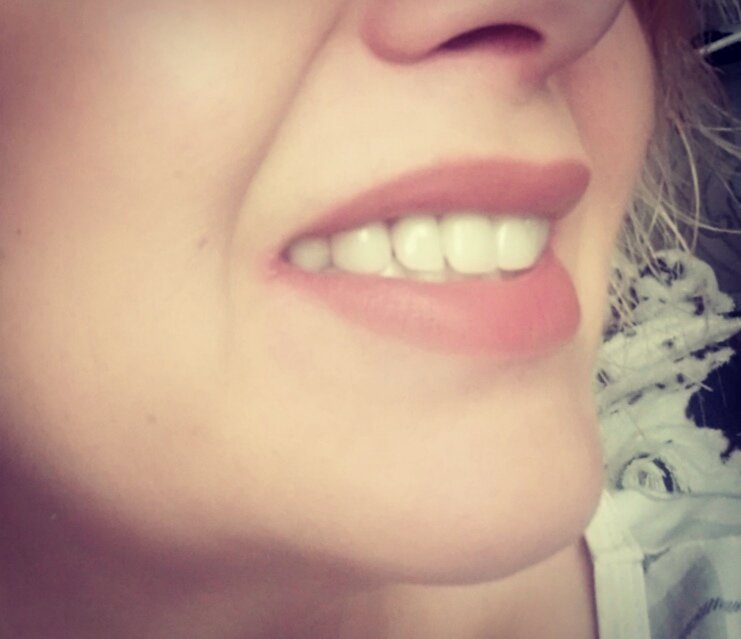 Мои любимые зубы